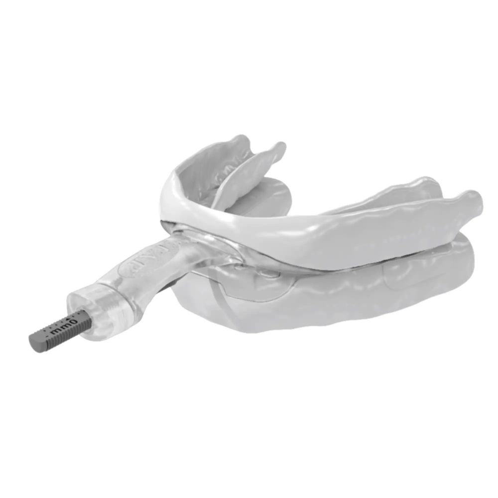 MyTAP Oral 2 Appliance